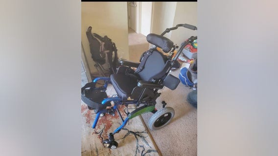 Wheelchair stolen from 2-year-old with cerebral palsy in West St. Paul