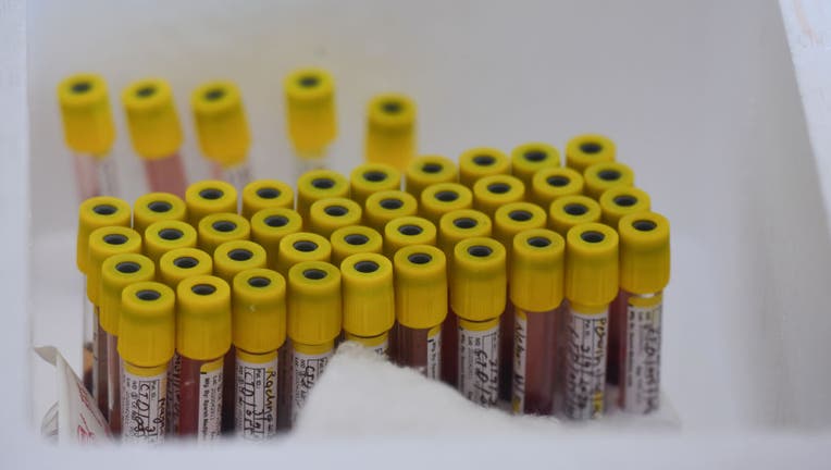 FILE - Health workers collects blood samples for Covid-19 antibody test during a serological survey at the Anganwadi Center near ITO in New Delhi. 