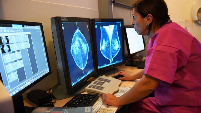 Mammogram