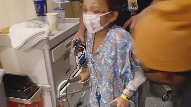 Girl, 5, injured in hit-and-run crash while crossing Minneapolis street