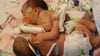 Otsego family celebrates miracle after conjoined twins survive separation