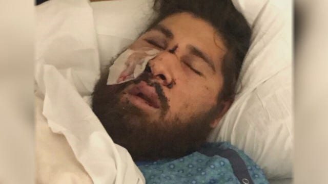 'Be mindful of your surroundings': Victim shot in Minneapolis carjacking speaks out