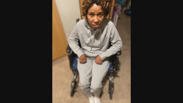 14 people struck by vehicles in St. Paul so far this year, 7 in hit-and-runs