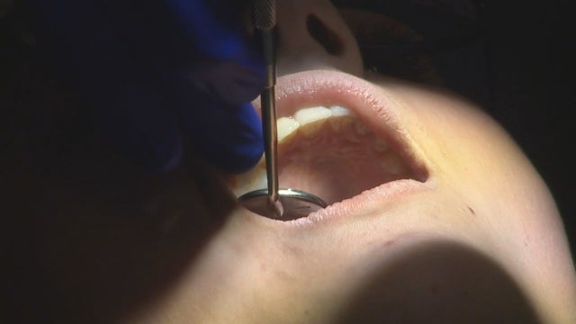 Dentists see increase in stress-related dental issues amid pandemic
