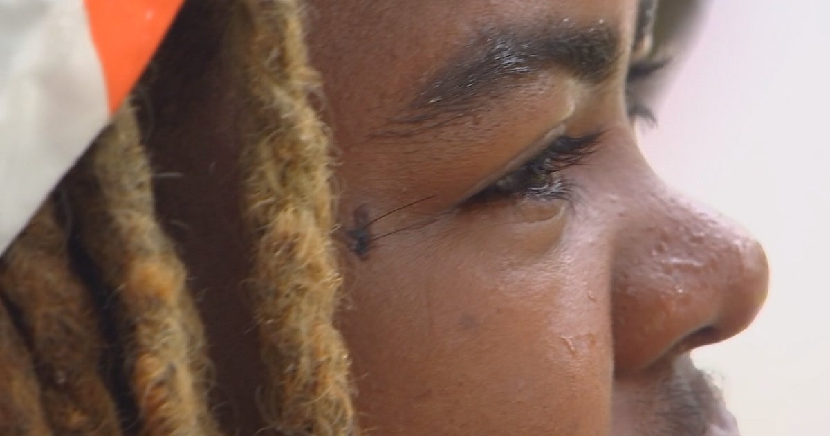 Man grazed by bullet in Minneapolis shooting recounts moments as shots ...