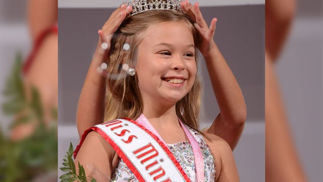 Miss Minnesota Jr., living with vitiligo, uses her platform to empower others