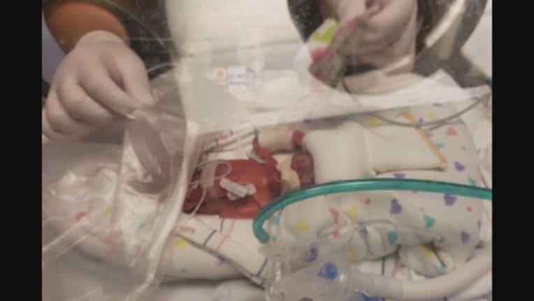Premature baby