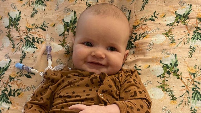 Minnetrista infant is the youngest Minnesotan waiting for heart transplant
