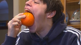 Minneapolis teen takes another bite of Guinness World Record for biggest mouth