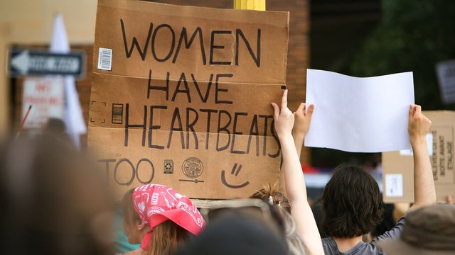 Roe v. Wade overturned: UnRestrict MN challenges restrictions in Minnesota abortion laws