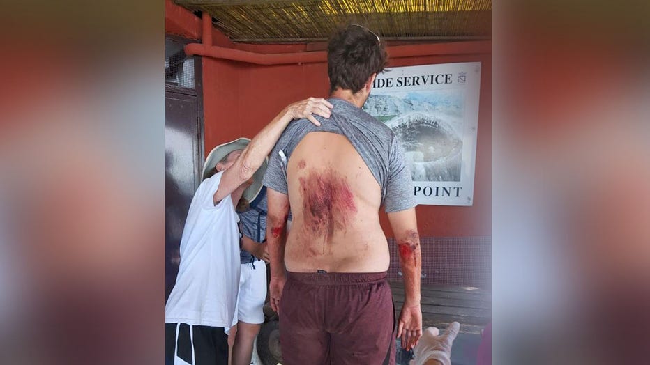 Man-injured-after-falling-into-volcano.jpg