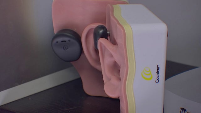 Hearing aids to be made available without a prescription this fall