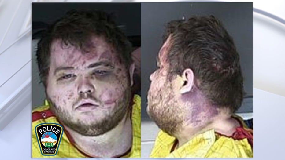Colorado gay club shooting suspect, visibly injured by patrons, held  without bail