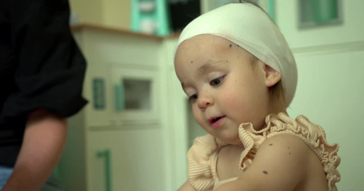 Farmington toddler living with never before seen medical condition | FOX 9 Minneapolis-St. Paul