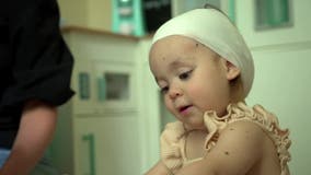 Farmington toddler living with never before seen medical condition
