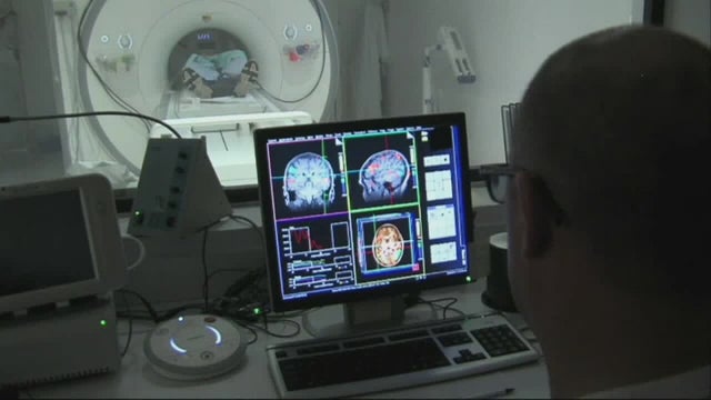 Minnesota counties with highest rates of Alzheimer's disease