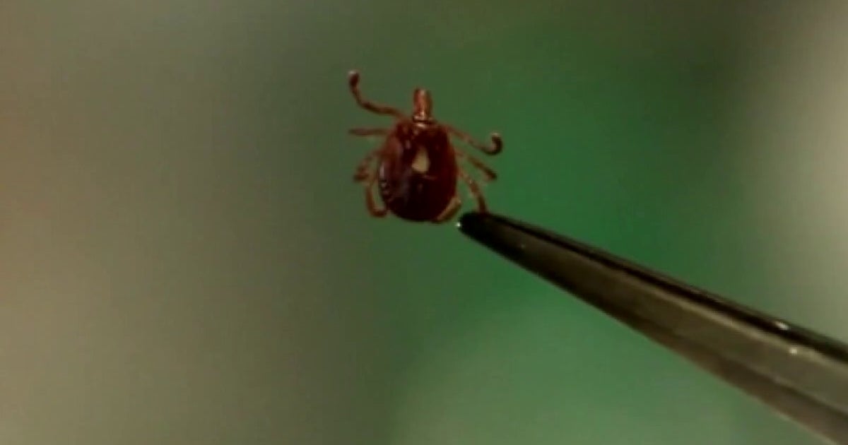 Fox File Tick Minnesota health officials monitoring increase in tularemia cases | FOX ...