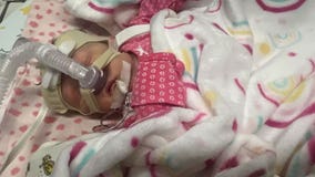 Roseau family seeks treatment for premature baby with 2 holes in heart; dad lost his job