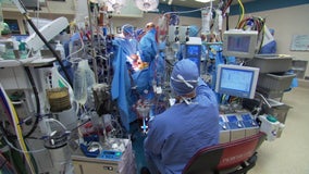 Mayo Clinic marks 60 years since first organ transplant