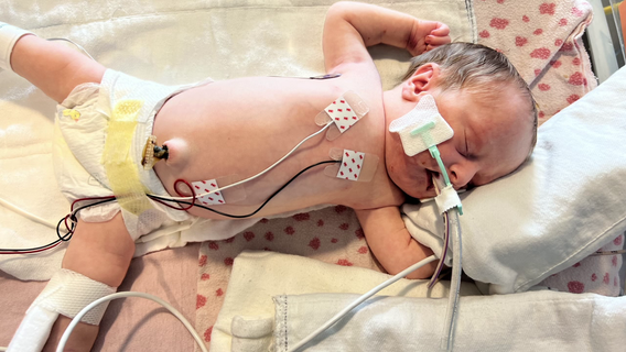 Baby hospitalized for 100 days returns home just in time for Christmas