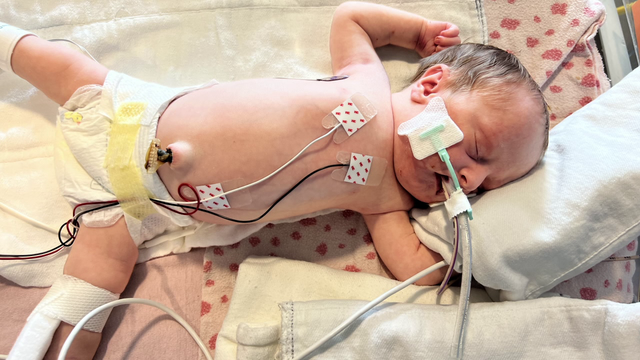 Baby hospitalized for 100 days returns home just in time for Christmas