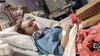 Sinus infection turns into emergency brain surgery for MN girl