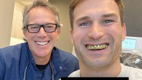 Vikings QB Kirk Cousins sports new gold grill