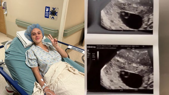 Georgia woman calls for separate waiting rooms for patients experiencing pregnancy loss