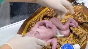 Doctors deliver baby via cesarean section after mother killed in Israeli airstrike