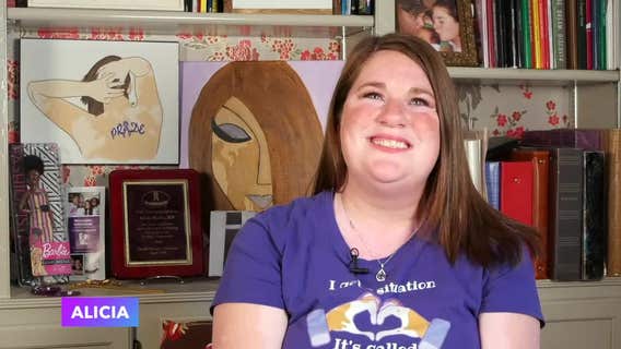 New Prague woman featured in documentary on living with vitiligo