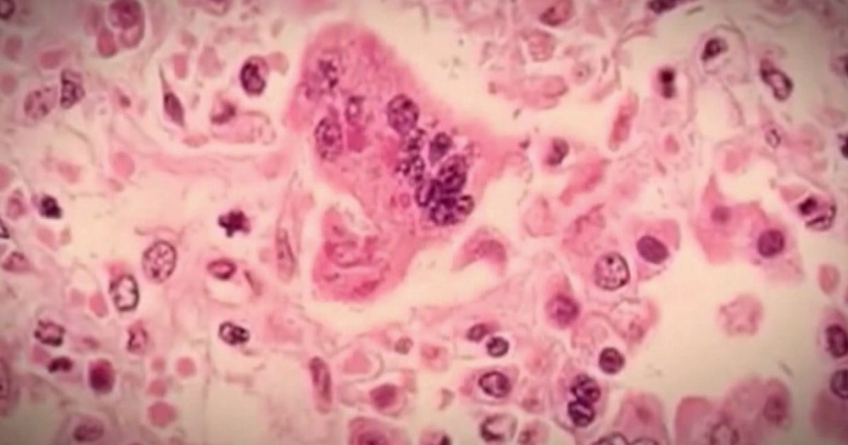 Minnesota bill would end vaccine exemptions for conscientious objectors