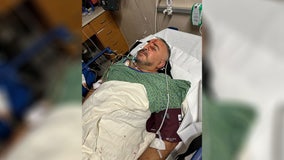 Plymouth man recovering from dog attack that left him seriously injured