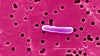 Twin Cities E. coli illnesses prompt nation-wide recall