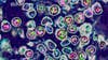 Minnesota health officials identify first measles case of 2025