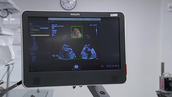 Gov. Walz touts Philips expansion in MN: 'That's how you bring manufacturing back'