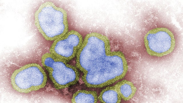 4 pediatric influenza deaths reported in MN this season, 2 in the past week
