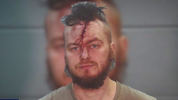 She was shot in the head. He was offered a plea deal.