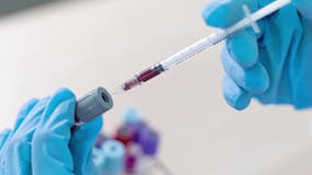 New FDA-approved Alzheimer’s blood test coming to Mayo Clinic