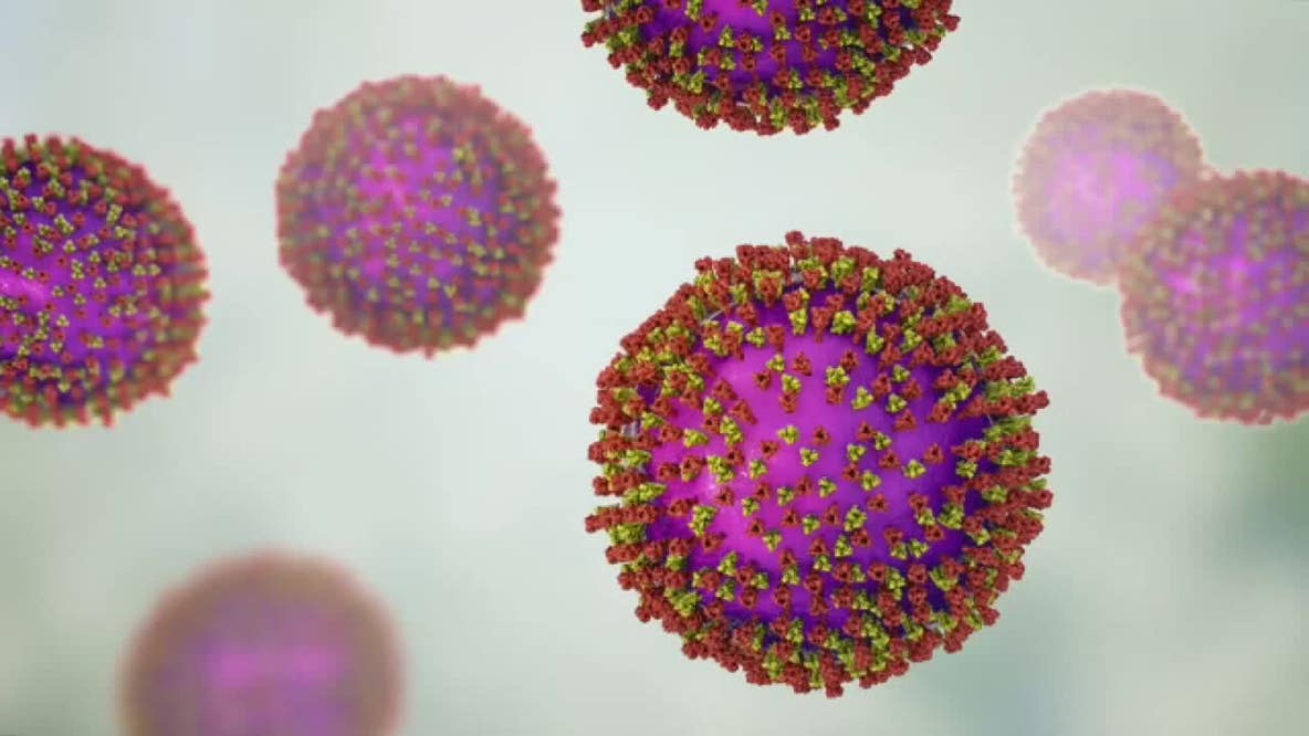 Wisconsin measles outbreak rises to 267 cases as spread continues