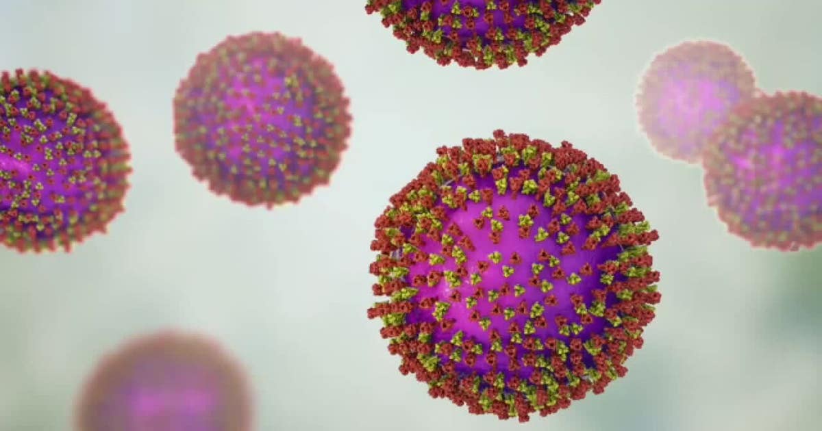 Wisconsin measles outbreak rises to 267 cases as spread continues
