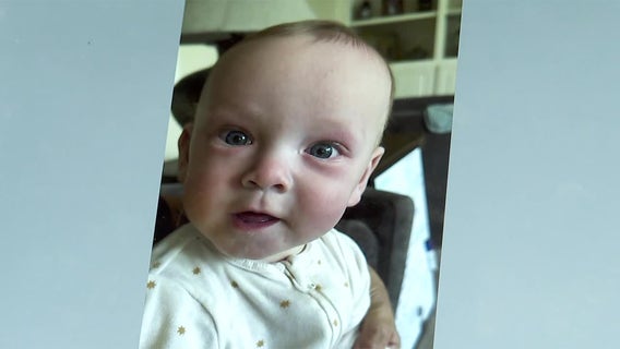 Lakeville baby supported by community ahead of heart surgery