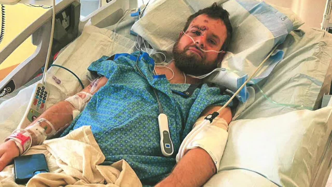 Metro Transit settles lawsuit with skateboarder for state max