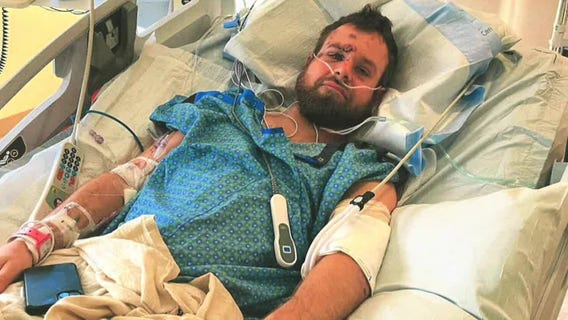 Metro Transit settles lawsuit with skateboarder for state max