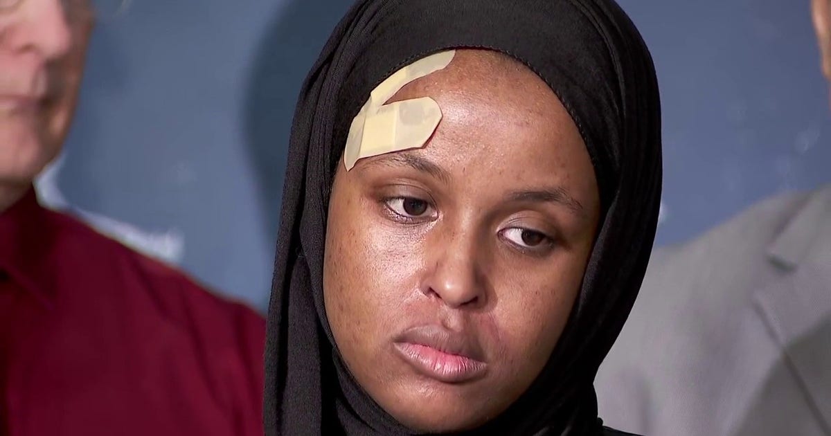 ICE in Minnesota: U.S. citizen says she was unjustly detained, suffered concussion