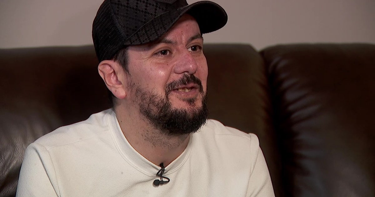 Libyan immigrant with rare genetic skin disorder detained by ICE tells story