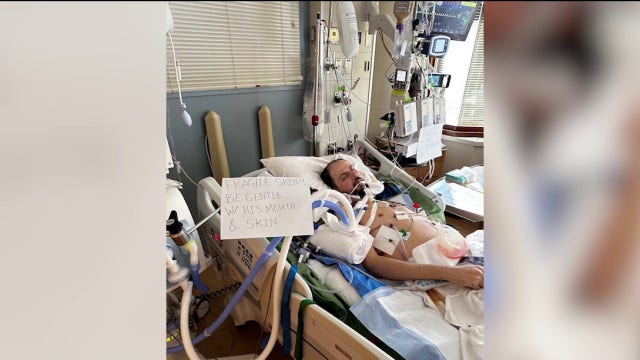 Woodbury man with rare skin disorder released from ICE custody, brother says