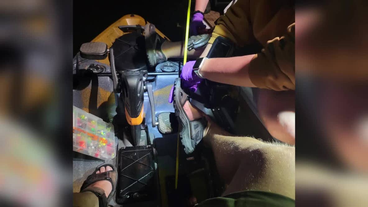 Firework debris impales man's foot with 'arrow-type object' in northern Minnesota