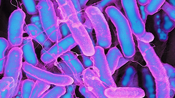 Minnesota, Wisconsin link E. coli and salmonella cases to alfalfa sprouts