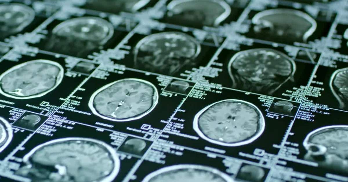 Walk for Thought 2025: Minnesota Brain Injury Alliance honors survivors at Long Lake Regional Park