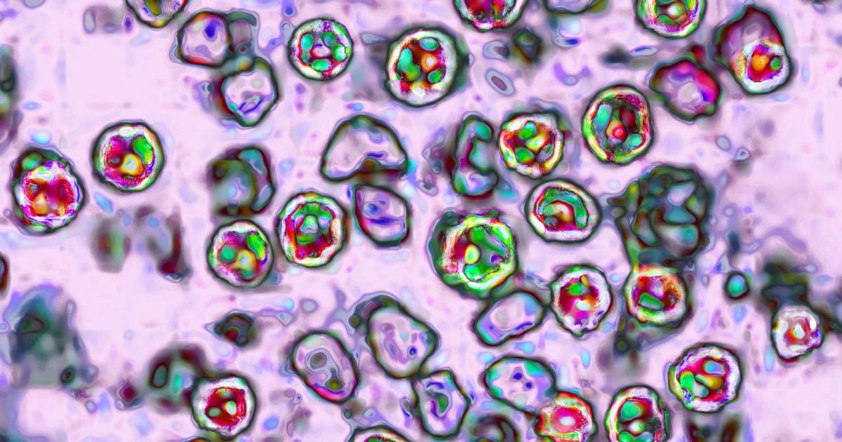 Measles in Wisconsin: Outbreak now has over 200 confirmed cases in Southwest Wisconsin